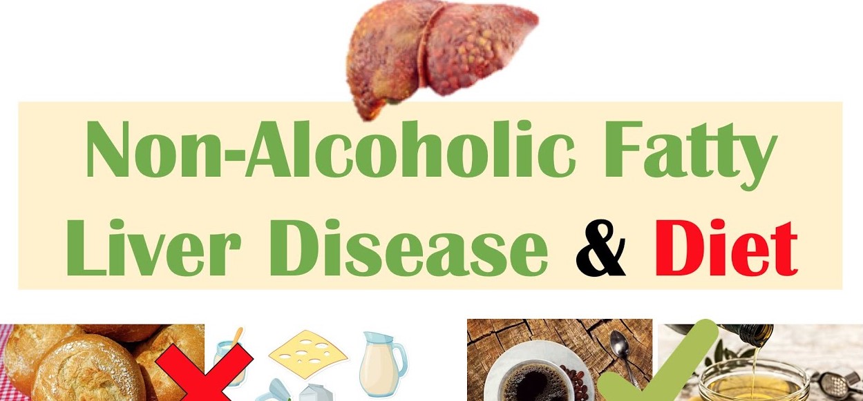 21-Day Fatty Liver Diet Plan in 2024