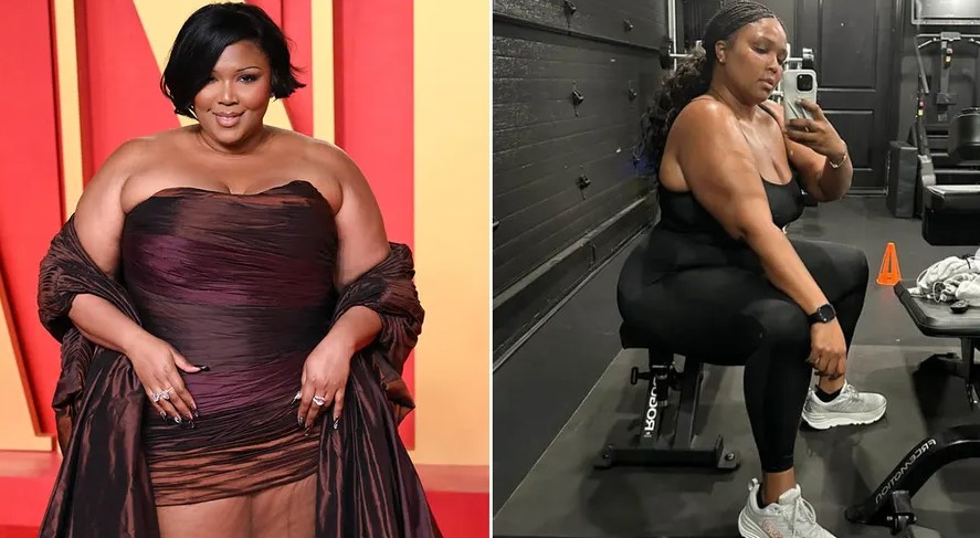 How Much Does Lizzo Weight Loss Surgery Cost in 2024?